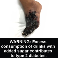 Graphic and grisly beverage warning labels stressing sugar content dangers could curb obesity, study