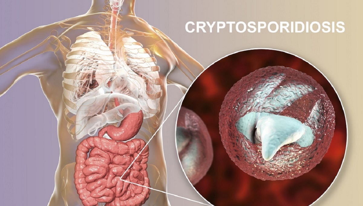 Rise in travel-related Cryptosporidium cases prompts warning