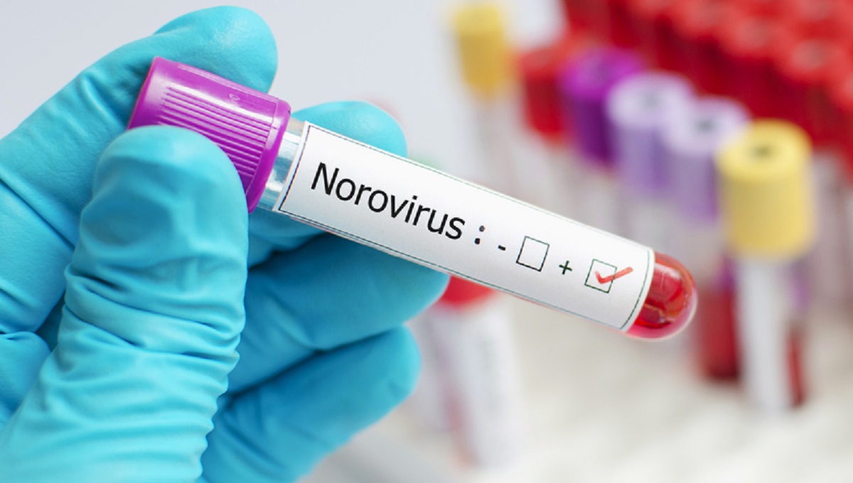 Norovirus tops expert ranking of foodborne viruses