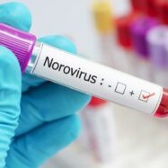 Study reveals food handlers contributed to norovirus outbreaks