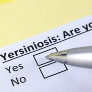 Yersinia findings in UK prompt call for better surveillance