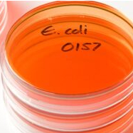 New E. coli O157:H7 outbreak detected