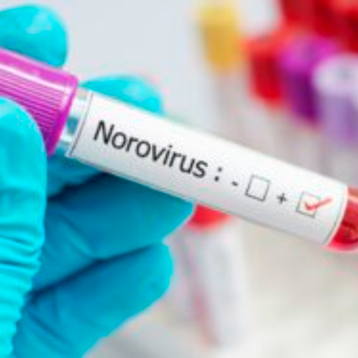 Norovirus behind outbreak that sickened almost 1,000 people in the Netherlands