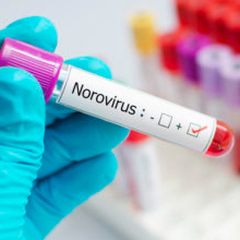 Norovirus dominates in Hong Kong outbreaks
