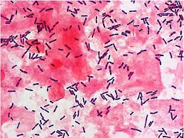 Anti - helicobacter pylori