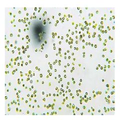 海洋微拟球藻